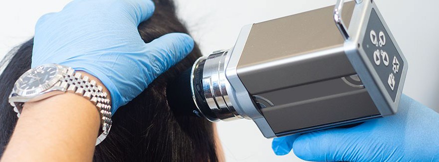 Wideodermatoskopia jako standard w diagnostyce chorób skóry głowy i łysienia – wywiad z ekspertem