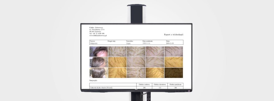Frontal Fibrosing Alopecia - łysienie czołowe bliznowaciejące