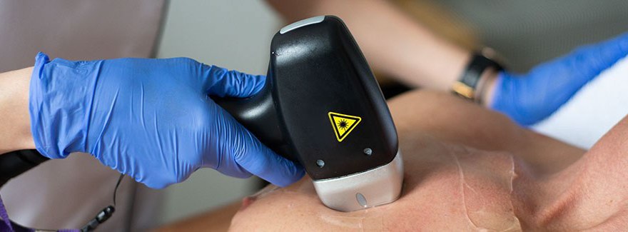 Jak dbać o skórę przed i po zabiegu depilacji laserowej?