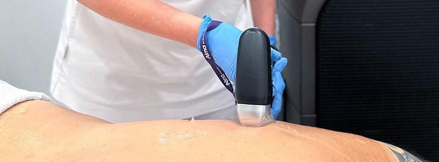 Wskazania medyczne do laserowego usuwania owłosienia