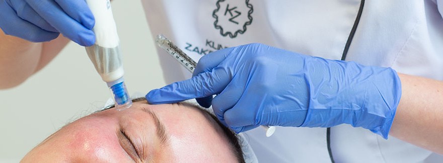 Regeneracja skóry dzięki nakłuwaniu i składnikom aktywnym