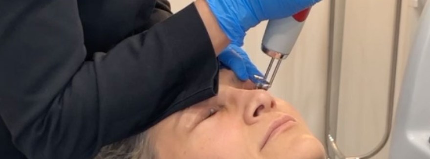10 najczęściej zadawanych pytań dotyczących laserowego usuwania makijażu permanentnego