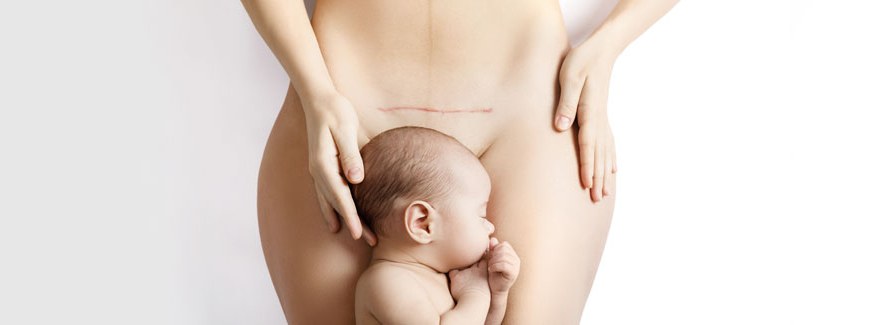 Piękna mama, czyli zabiegi estetyczne po ciąży