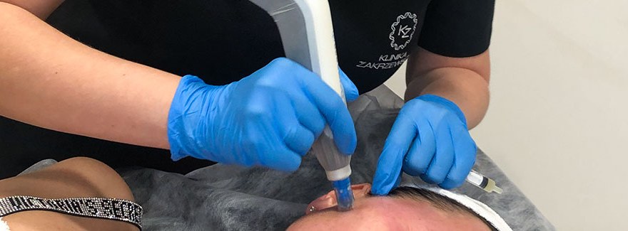 Zabiegi regeneracyjne, po których skóra potrzebuje okresu rekonwalescencji