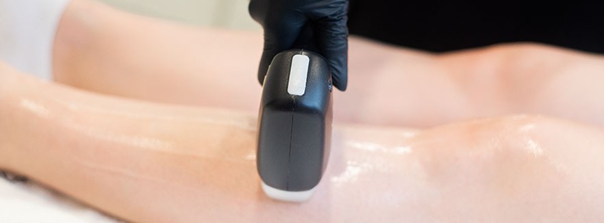 5 zalet depilacji laserowej, które musisz znać