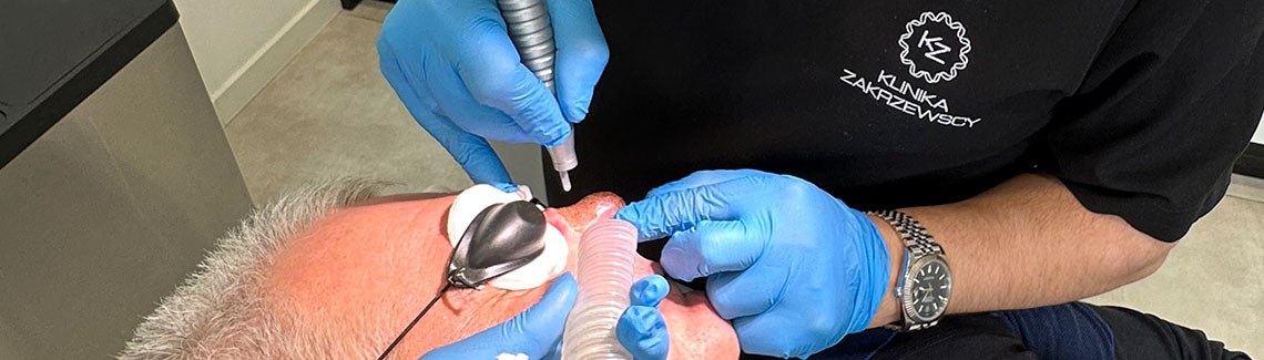 Laseroterapia w leczeniu rhinophymy, czyli guzowatości nosa