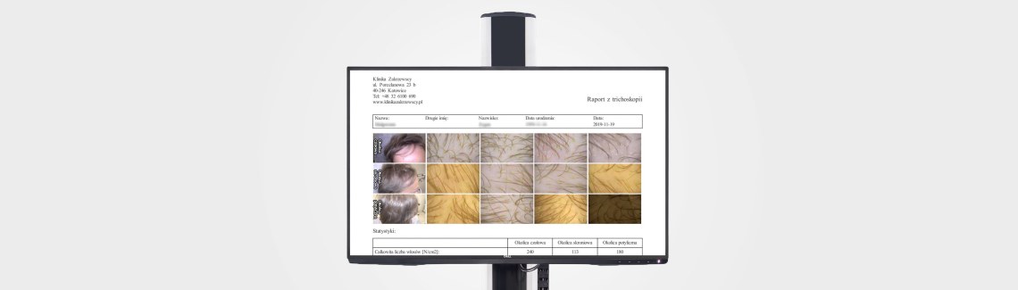 Frontal Fibrosing Alopecia - łysienie czołowe bliznowaciejące
