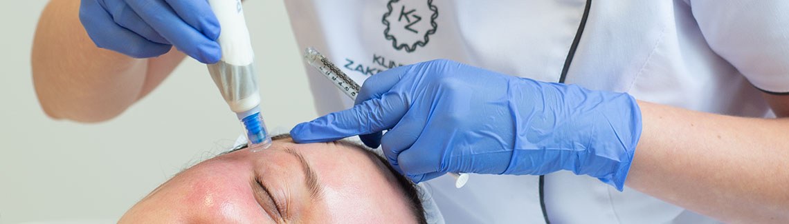 Regeneracja skóry dzięki nakłuwaniu i składnikom aktywnym