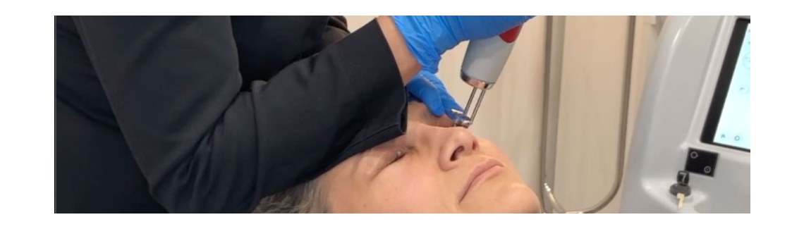 10 najczęściej zadawanych pytań dotyczących laserowego usuwania makijażu permanentnego