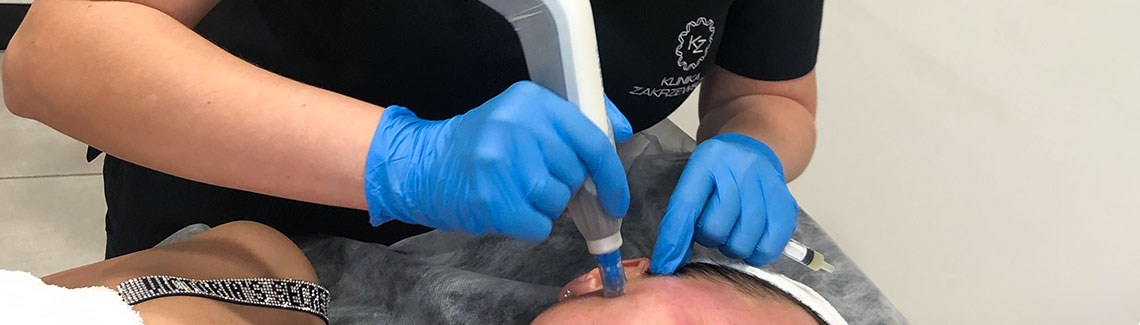 Zabiegi regeneracyjne, po których skóra potrzebuje okresu rekonwalescencji