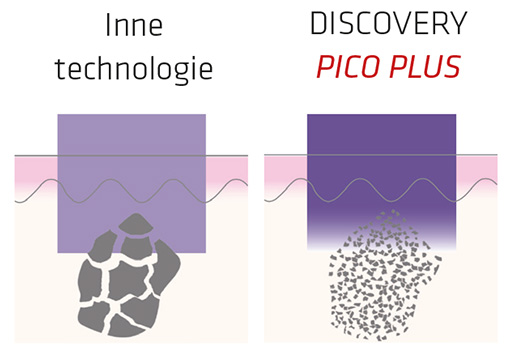 laser discovery pico